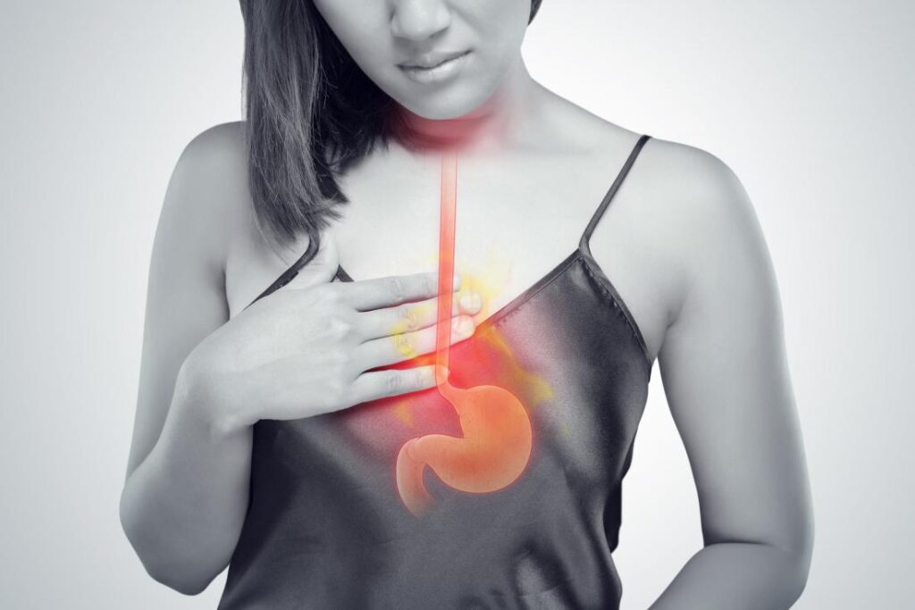 GERD (Gastroesophageal Reflux Disease)